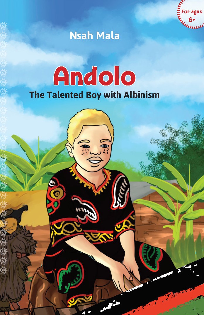Andolo The Talented Boy with Albinism